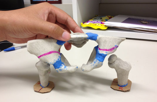 Researchers at the University of Alberta are using 3D printed models from Emily Carr to expedite surgical planning, with the goal of reducing operating time and improving patient safety. PHOTO: SSRL website